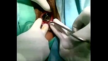 Iranian woman put a light bulb in her vagina to experience new masturbation sensations