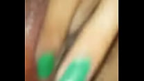 An Iranian doctor set up a hidden camera and fucked a patient